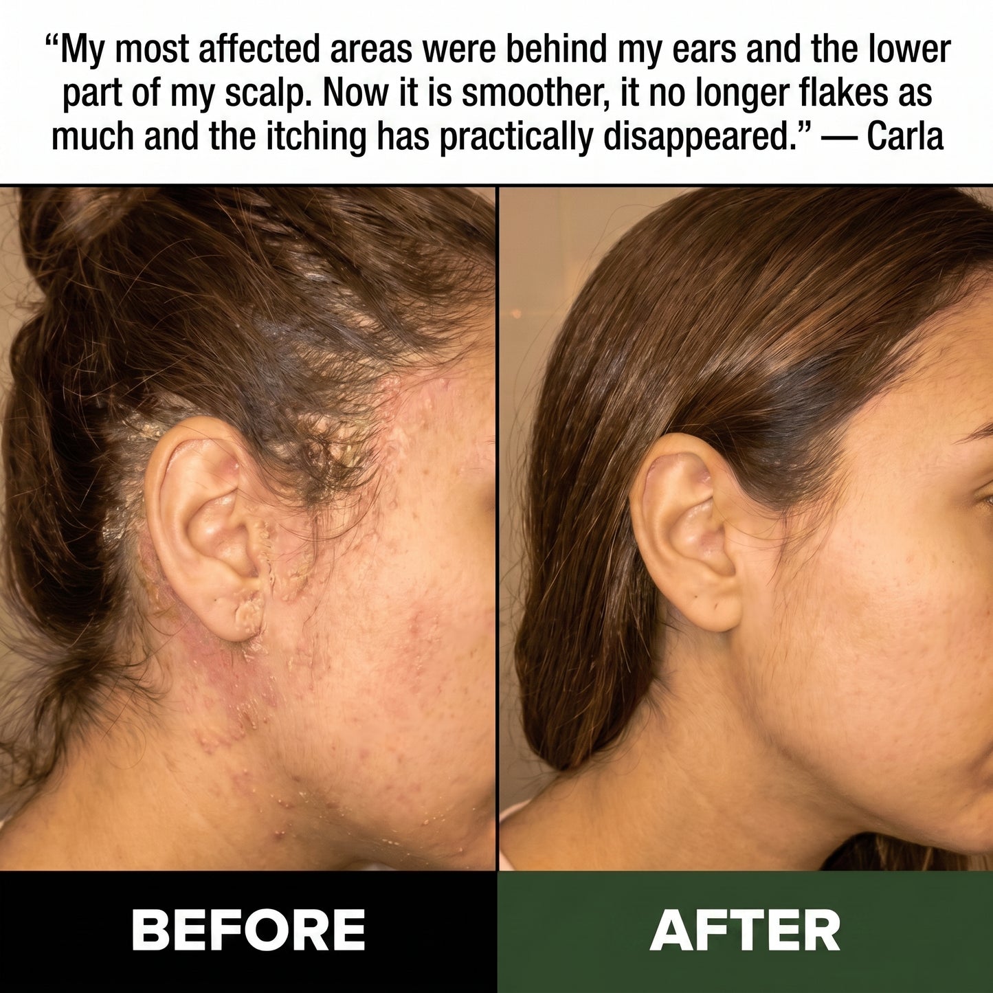 Kivarea Natural Scalp Scrub